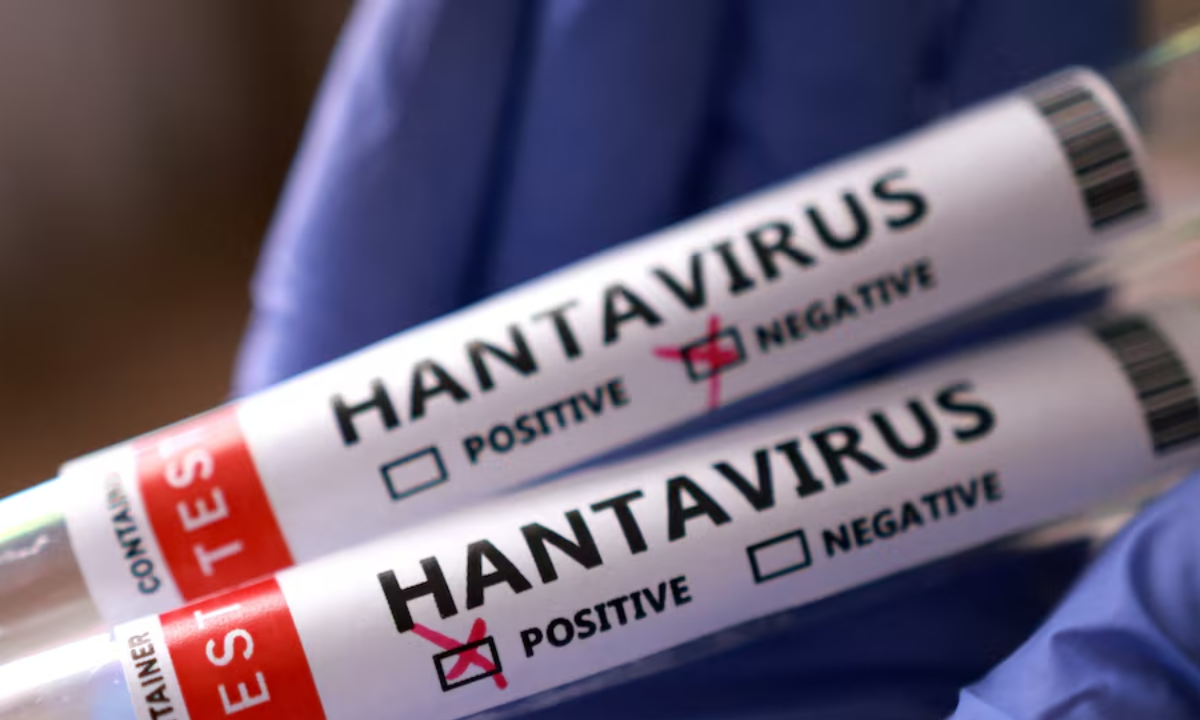 Hantavírus no MV Hondius tem novo caso confirmado e mantém alerta sanitário